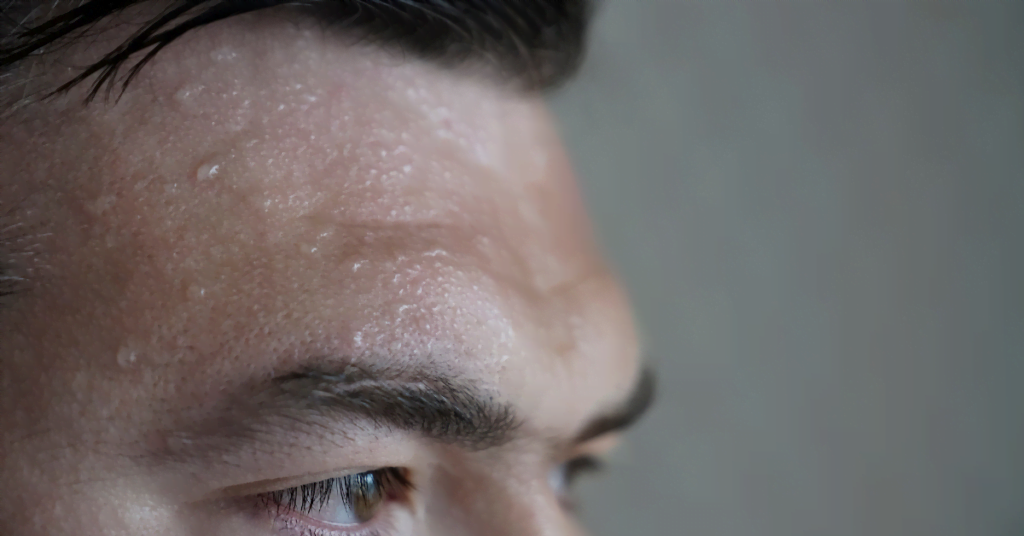 Treating sweaty feet – hyperhidrosis on feet